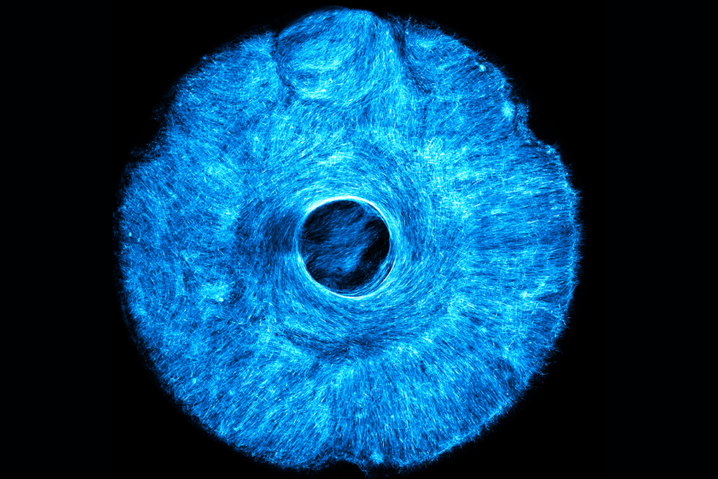 MIT engineers grew an artificial, muscle-powered structure that pulls both concentrically and radially, much like how the iris in the human eye acts to dilate and constrict the pupil. Credits:Image: Courtesy of the researchers A blue image that looks like an iris.